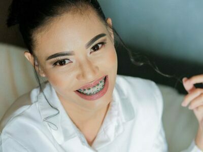 Orthodontic Consultation