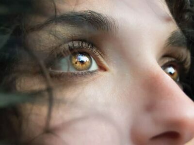 Ptosis