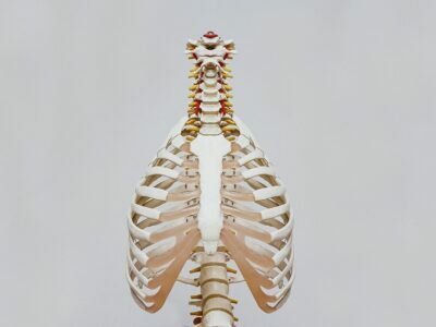 Spinal Stenosis