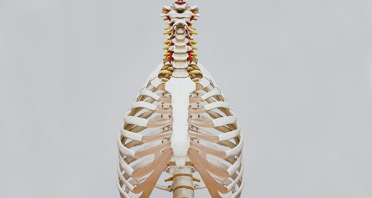<strong>5 Essential Tips to Prevent the Spinal Stenosis</strong> Spinal Stenosis
