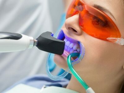 Top Benefits of Undergoing In-office Teeth Whitening Treatment Whitening Treatment
