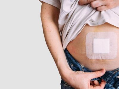 Hernia