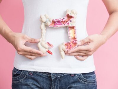 Colorectal Cancer