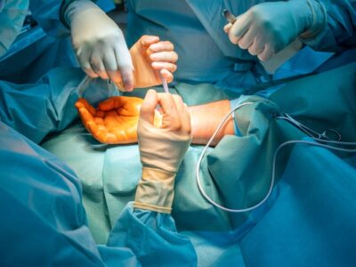 Hand Surgery