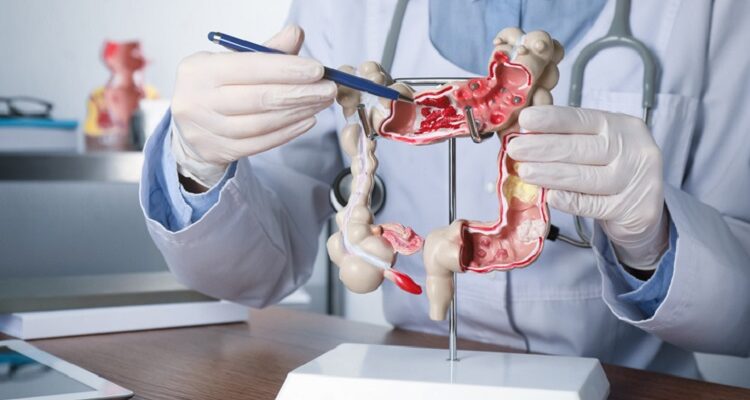 Top Questions to Ask Your Gastroenterologist Gastroenterologist