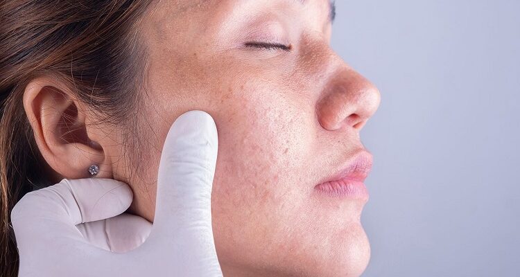 Ethical Aspects In Dermatology: A Closer Loo Dermatology