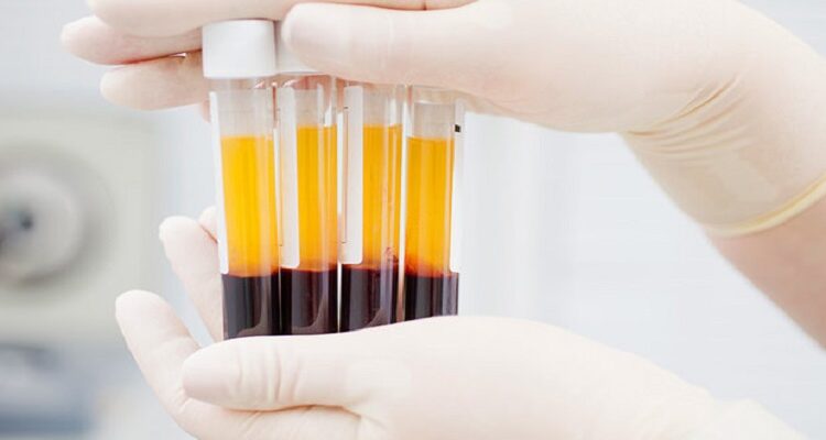 Blood Plasma
