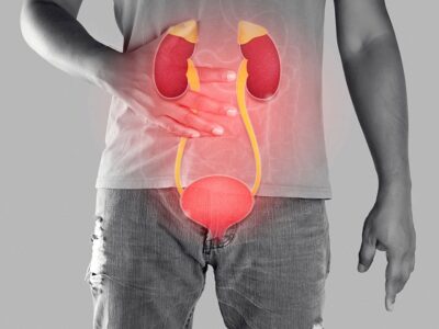 Cystitis